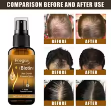 Laca para el cabello con biotina - Compra 1 y llévate 2